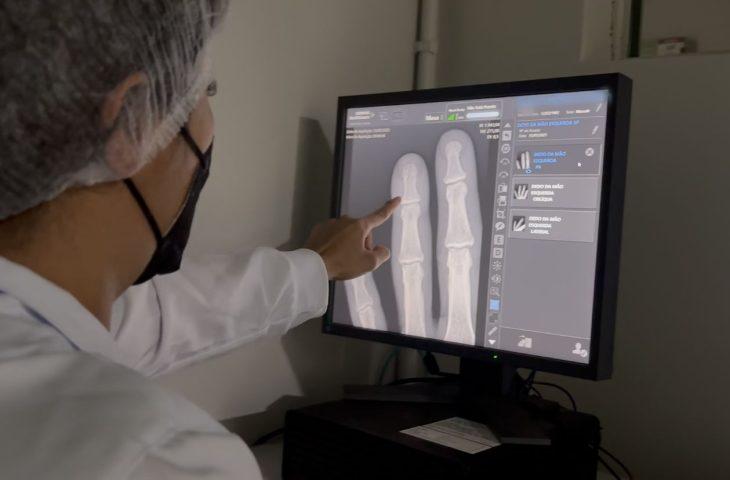 Governo entrega ultrassom e raio-x de alta resolução que ampliam precisão em mais de 600 exames por mês.