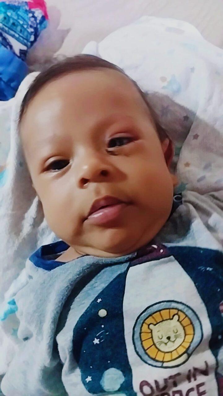 Cirurgia do bebê Henry, realizada pelo vereador Dr. Lívio, foi um sucesso.